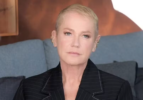 Xuxa revela ter alopecia; especialista indica cuidados pós-diagnóstico