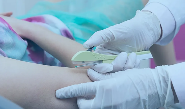 Implanon no SUS: entenda os benefícios e funcionamento do contraceptivo