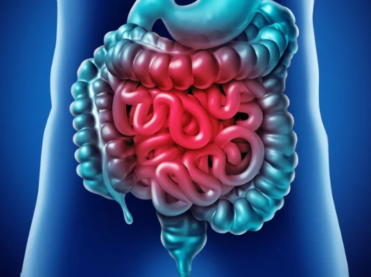 Câncer de intestino que vitimou Preta Gil é o 3º mais comum no país