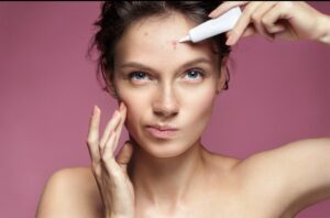 Os melhores hidratantes para pele com tendência à acne (e como escolher o ideal)