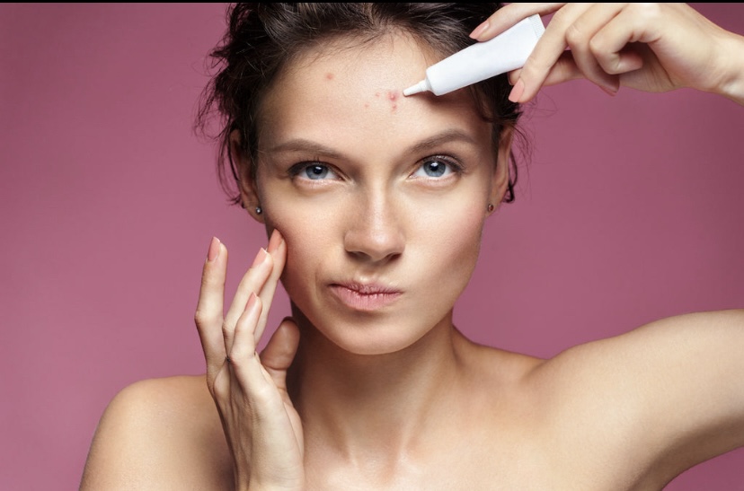 Os melhores hidratantes para pele com tendência à acne (e como escolher o ideal)