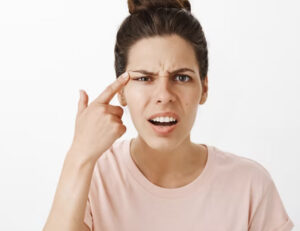 Sobrancelhas falhadas: o que pode causar a perda de pelos nessa região