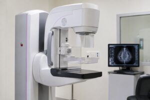 Planos de saúde passam a cobrir mamografia digital sem restrição de idade ou gênero